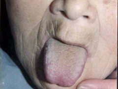 中醫望色之面青灰