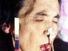 中醫(yī)望色之面色淡白，舌紅光瑩