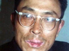 中醫望色之面色黧黑2