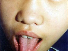中醫望色之面色青黃