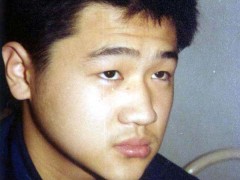 中醫望色之面色萎黃