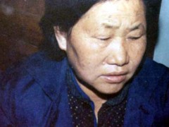 中醫望色之面色黃白