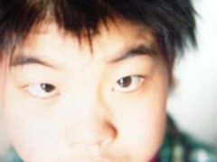 中醫望神之神志異常癡呆