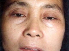 中醫望診之虛證少神1