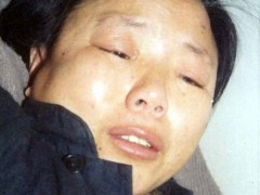 中醫(yī)望神之臟躁