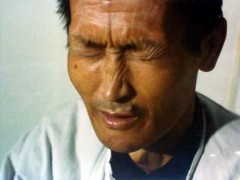 中醫望色之病色青黃