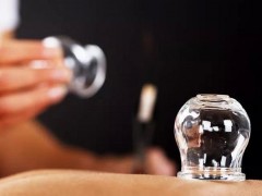 中醫(yī)拔罐能減肥嗎？
