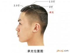 承光穴，承光穴準確位置圖和作用及功效
